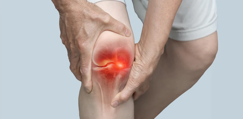 Rheumatoid Arthritis